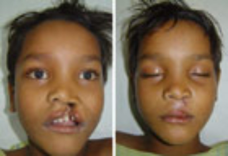 smiletrain