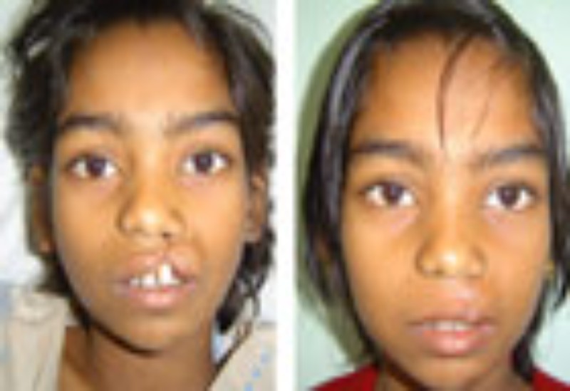 smiletrain